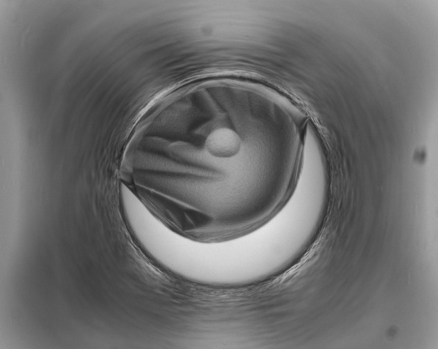 X0000098221369200805081148