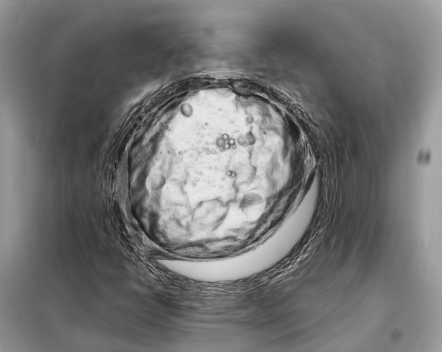 X0000098221398200805081147