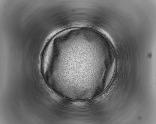 X0000098221419200805081147