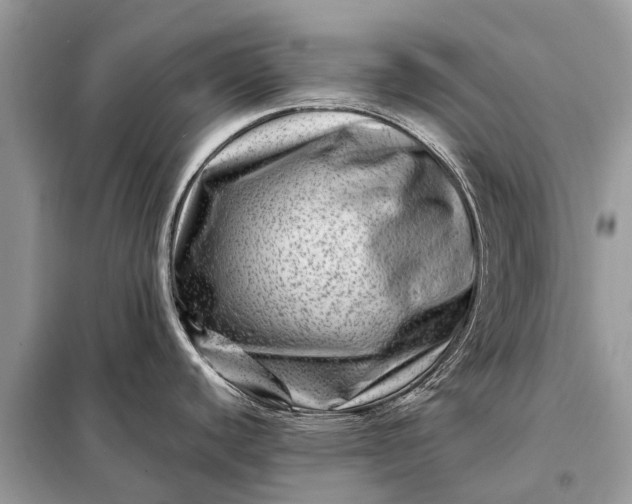 X0000098221440200805081148