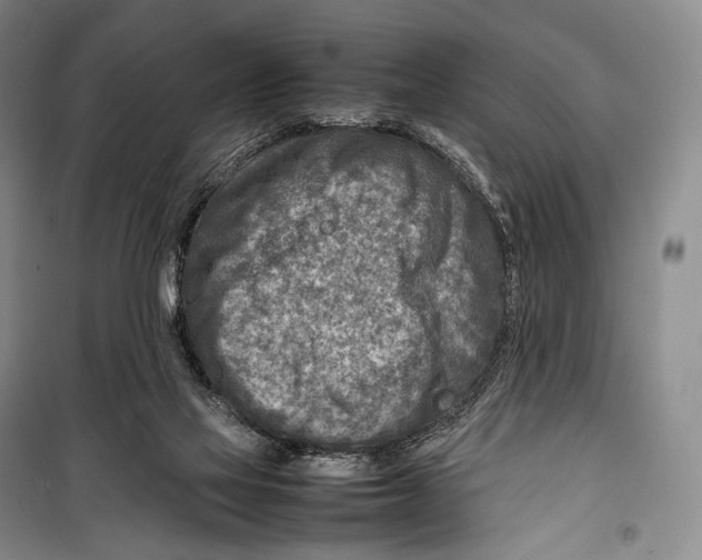 X0000098220069200805151327