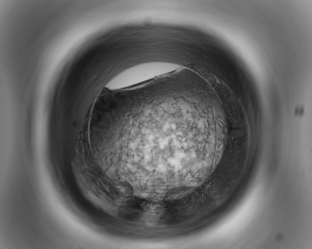 X0000098220143200805151326