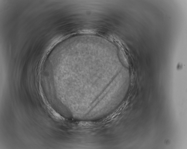 X0000098220145200805151325