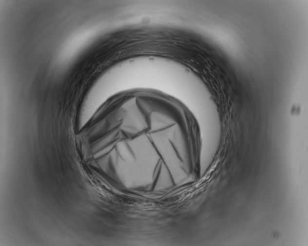 X0000098220146200805151325