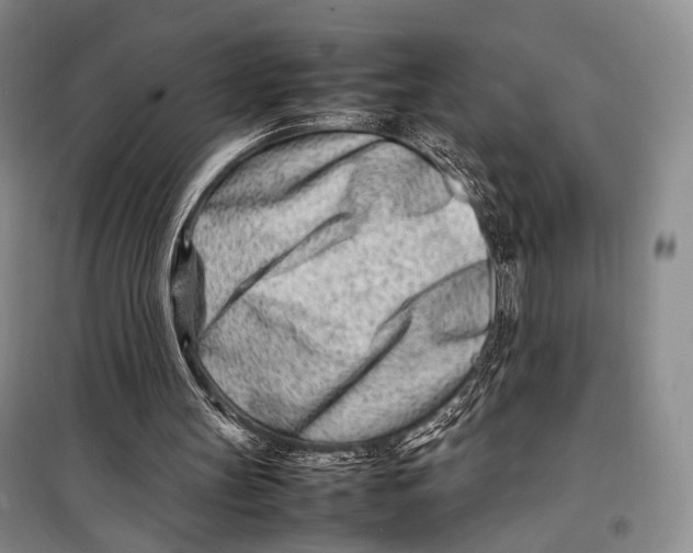 X0000098220147200805151325