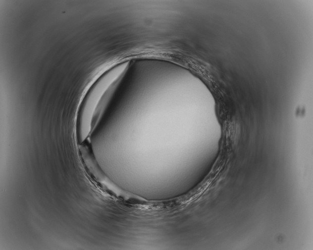 X0000098220148200805151325