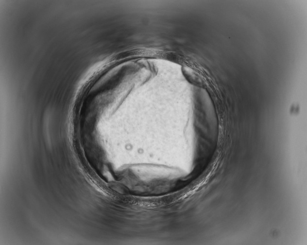 X0000098220149200805151325