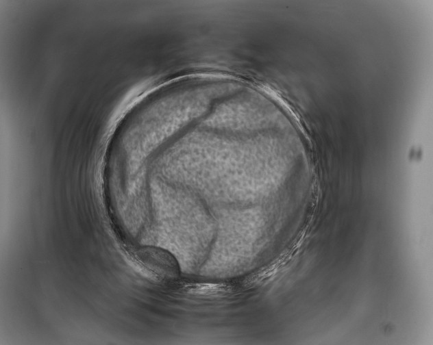 X0000098220151200805151325