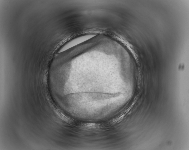 X0000098220153200805151325