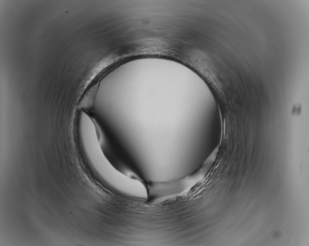 X0000098220156200805151325