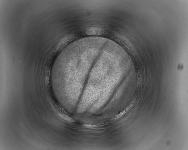 X0000098220171200805151325