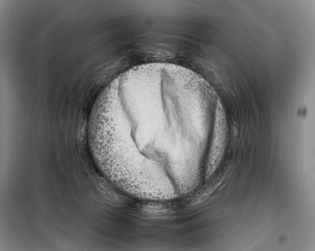 X0000098220177200805151325