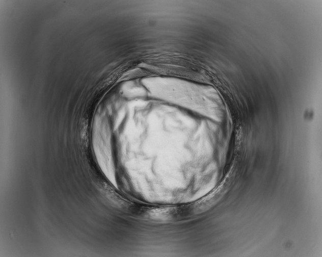 X0000098220178200805151325