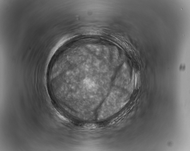 X0000098220195200805151325