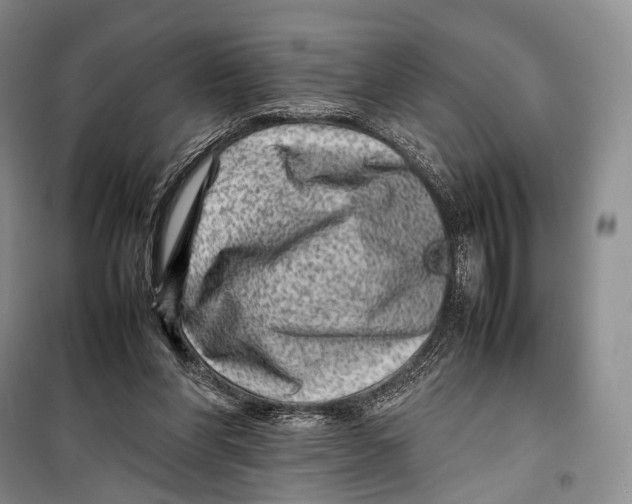 X0000098220206200805151325