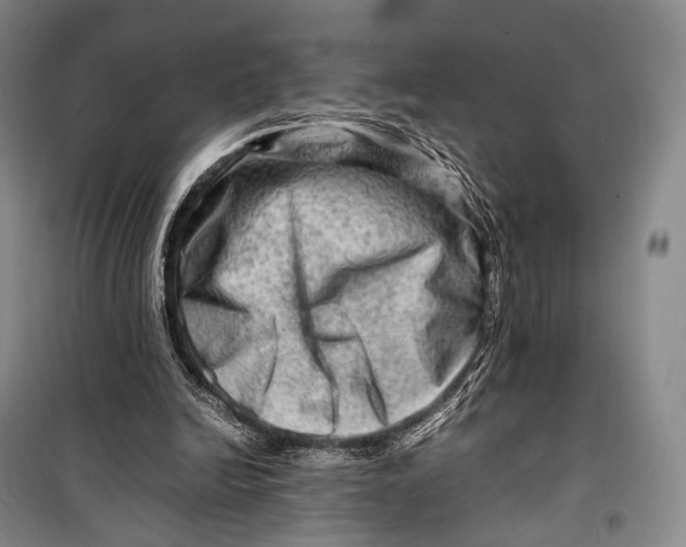 X0000098220246200805151324