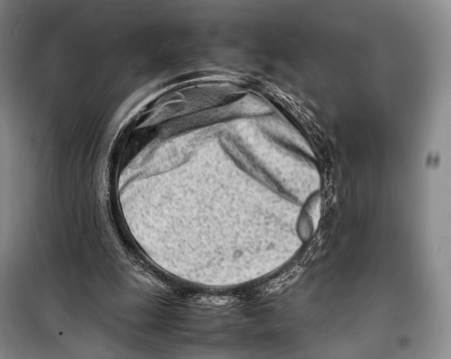 X0000098220247200805151324