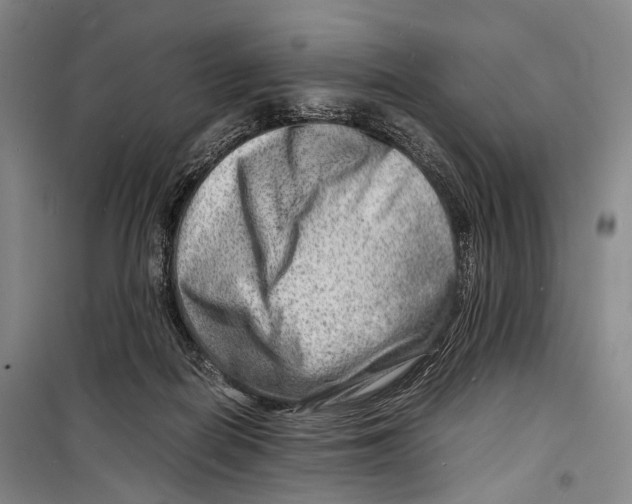 X0000098220266200805151324