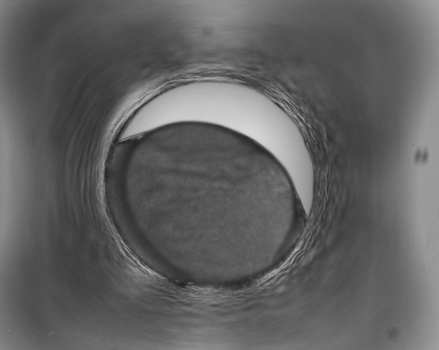 X0000098220293200805151323