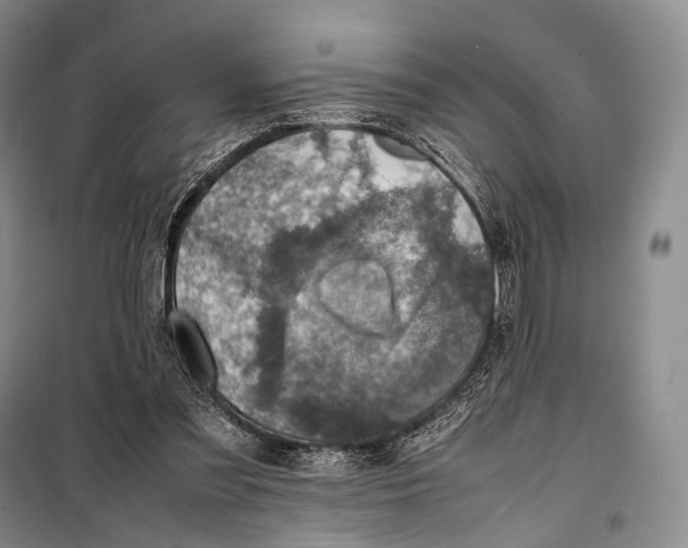 X0000098220301200805151323