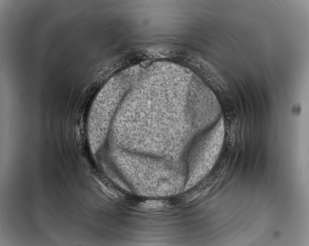 X0000098220418200805151322