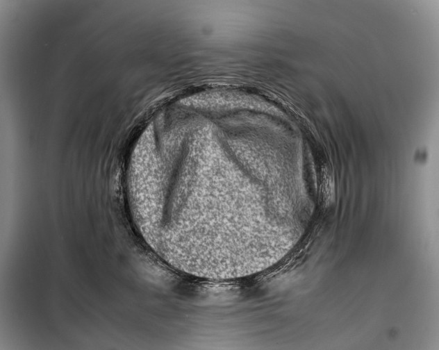 X0000098220619200805151319