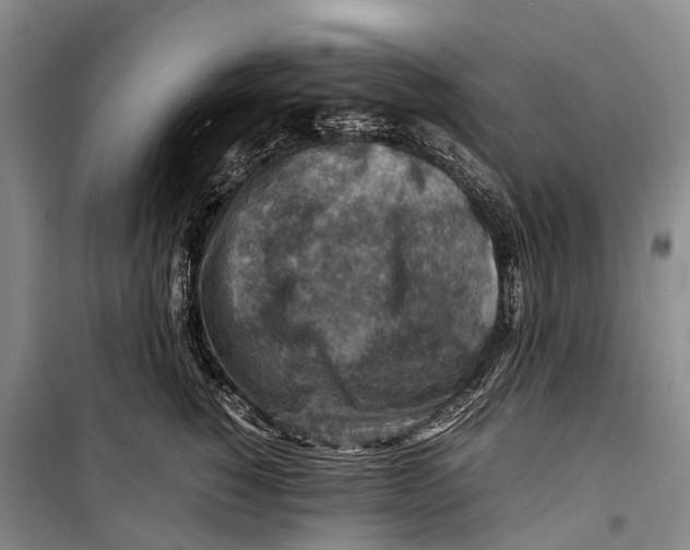 X0000098220760200805151317