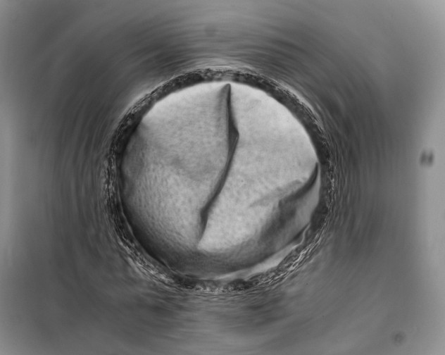 X0000098220775200805151316