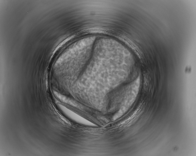 X0000098220782200805151316