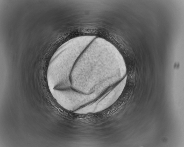 X0000098220817200805151315