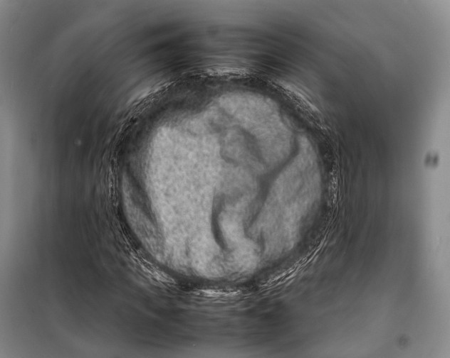 X0000098220917200805151314