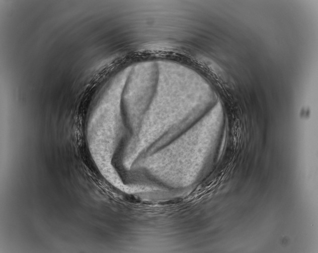 X0000098221062200805151312