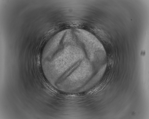 X0000098221106200805151310