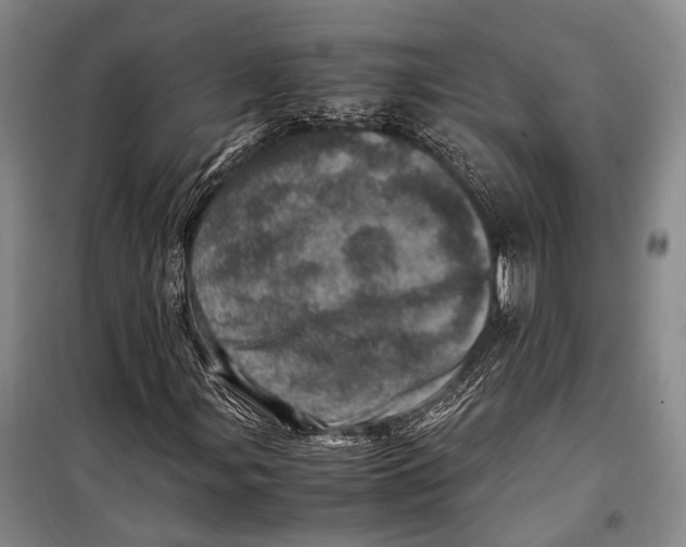 X0000098221107200805151310