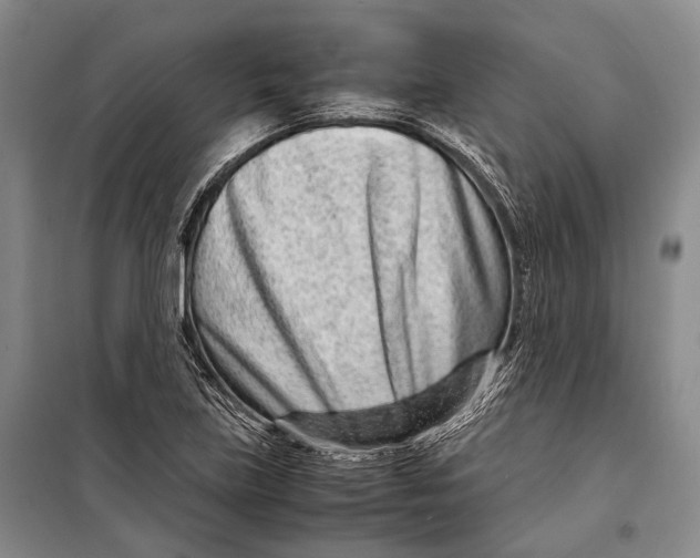 X0000098221219200805151309