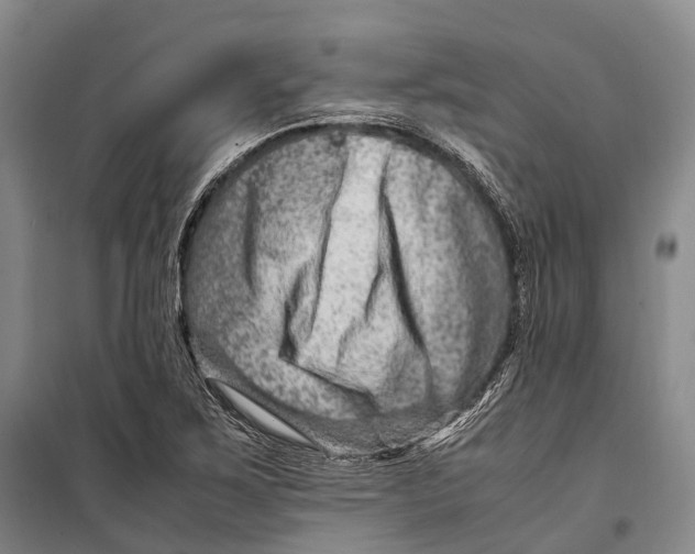 X0000098221267200805151308