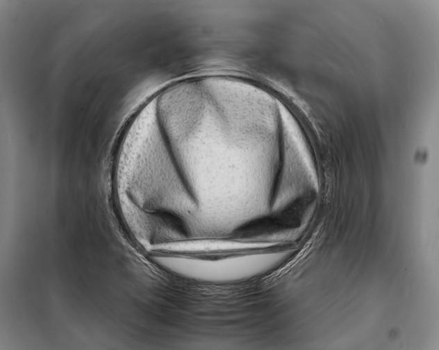 X0000098221415200805151306