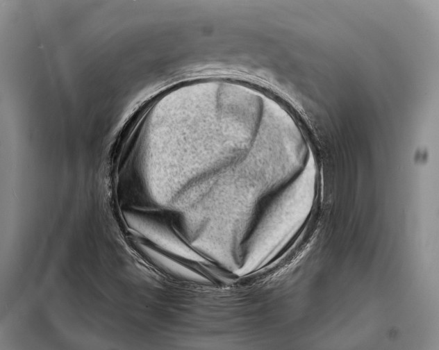 X0000098221501200805151304