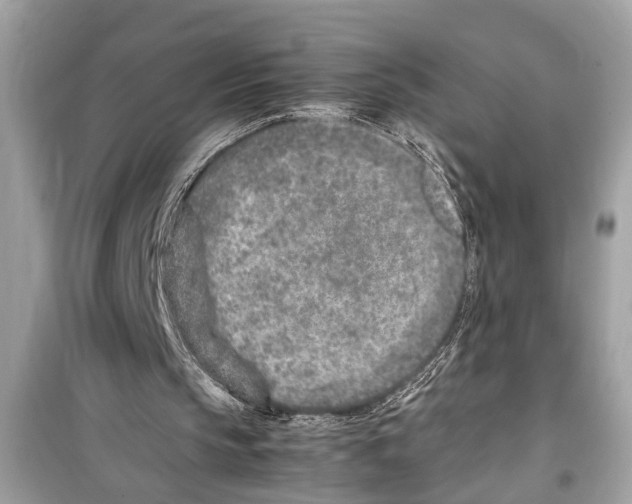 X0000098220145200805221655
