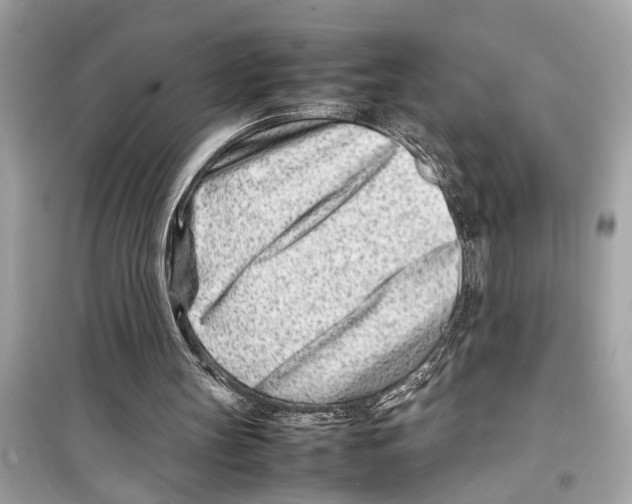 X0000098220147200805221655