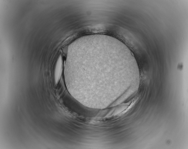 X0000098220170200805221656