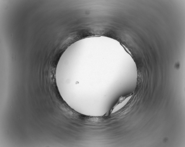 X0000098220237200805221655