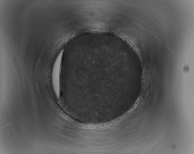 X0000098230017200805011309
