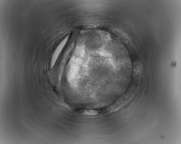 X0000098230369200805151347