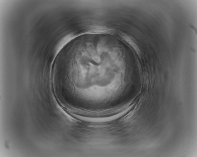 X0000099231487200804241443