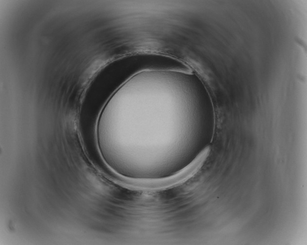 X0000099230060200805011145