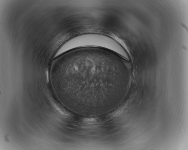 X0000099230061200805011145