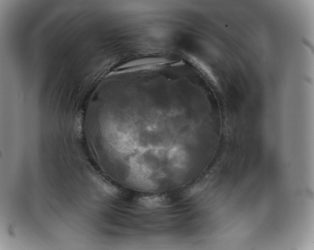 X0000099230065200805011145