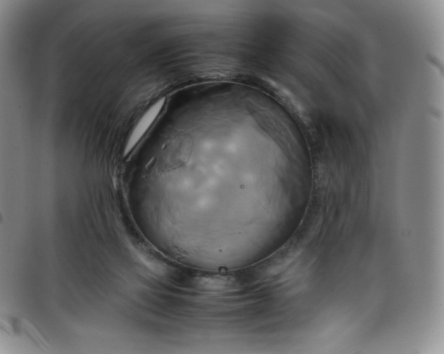 X0000099230069200805011145