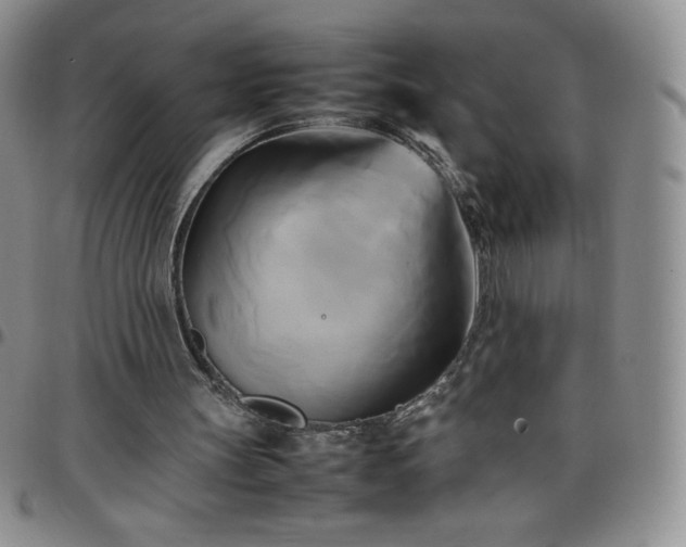 X0000099230147200805011144